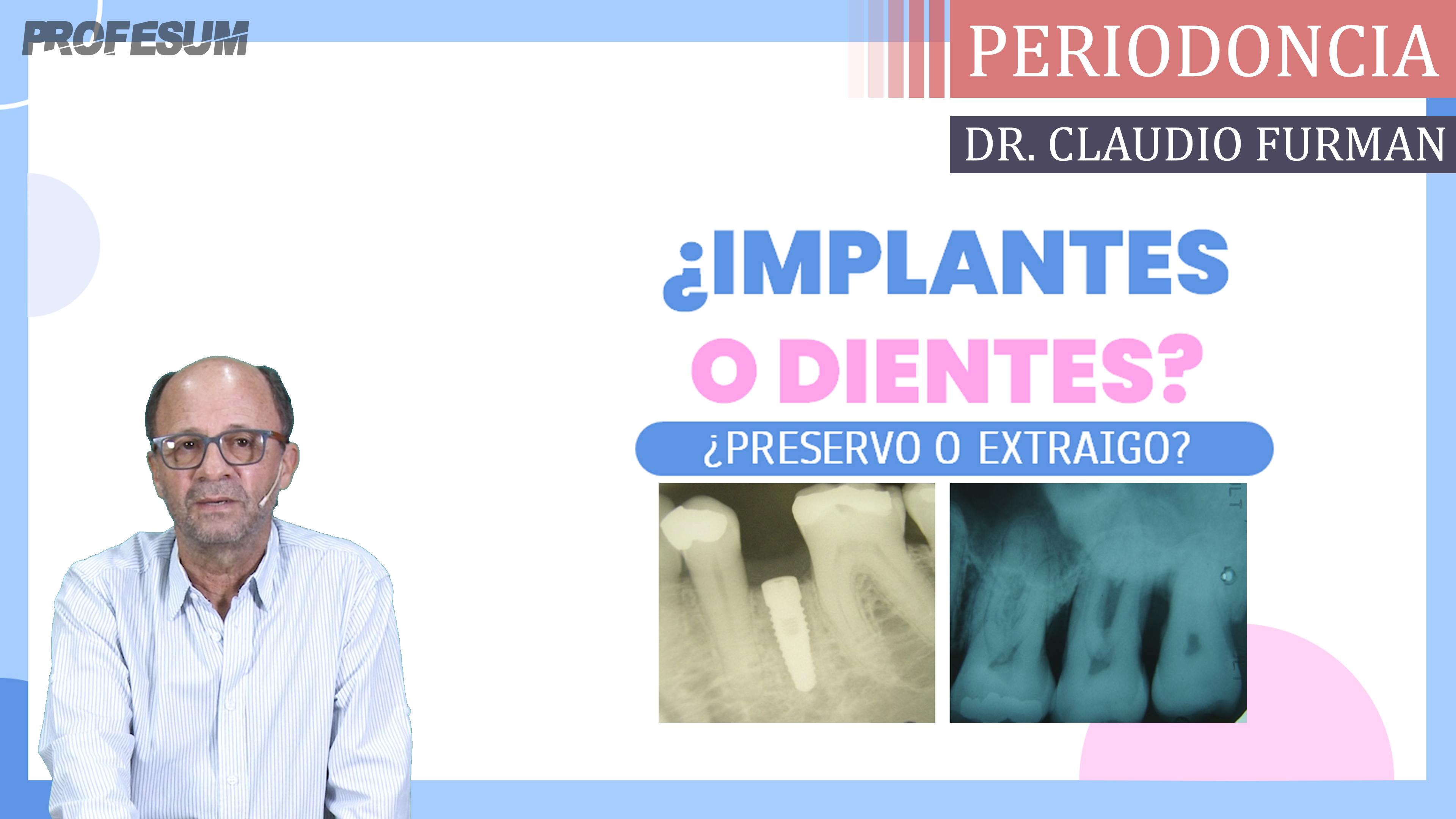 ¿Implantes o Dientes? ¿Preservo o Extraigo? - Dr. Claudio Furman