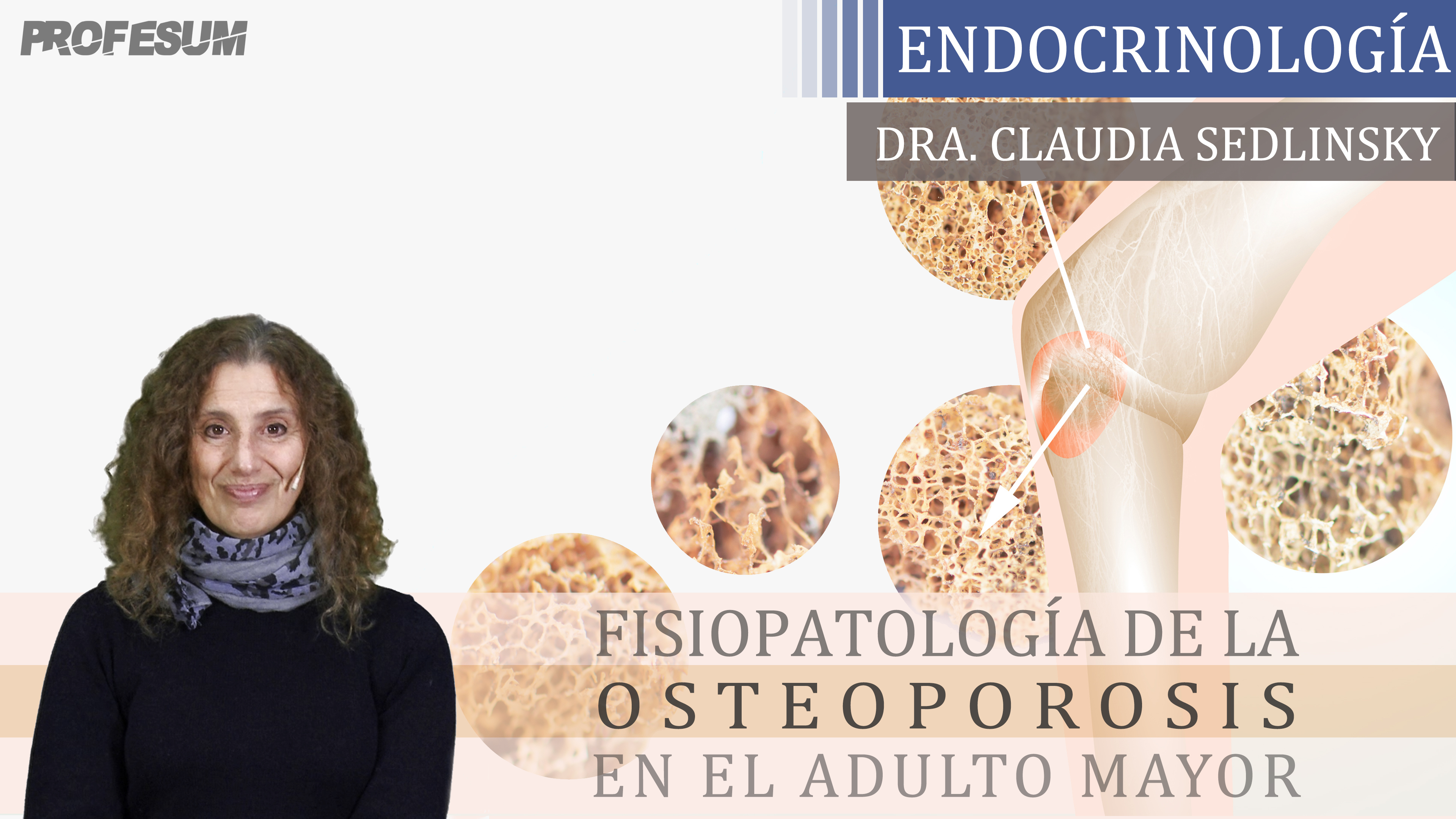 Fisiopatología de la Osteoporosis en el Adulto Mayor - Dra. Claudia Sedlinsky
