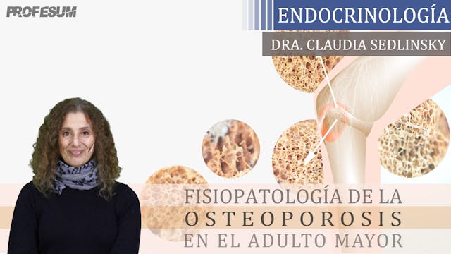 Fisiopatología de la Osteoporosis en ...