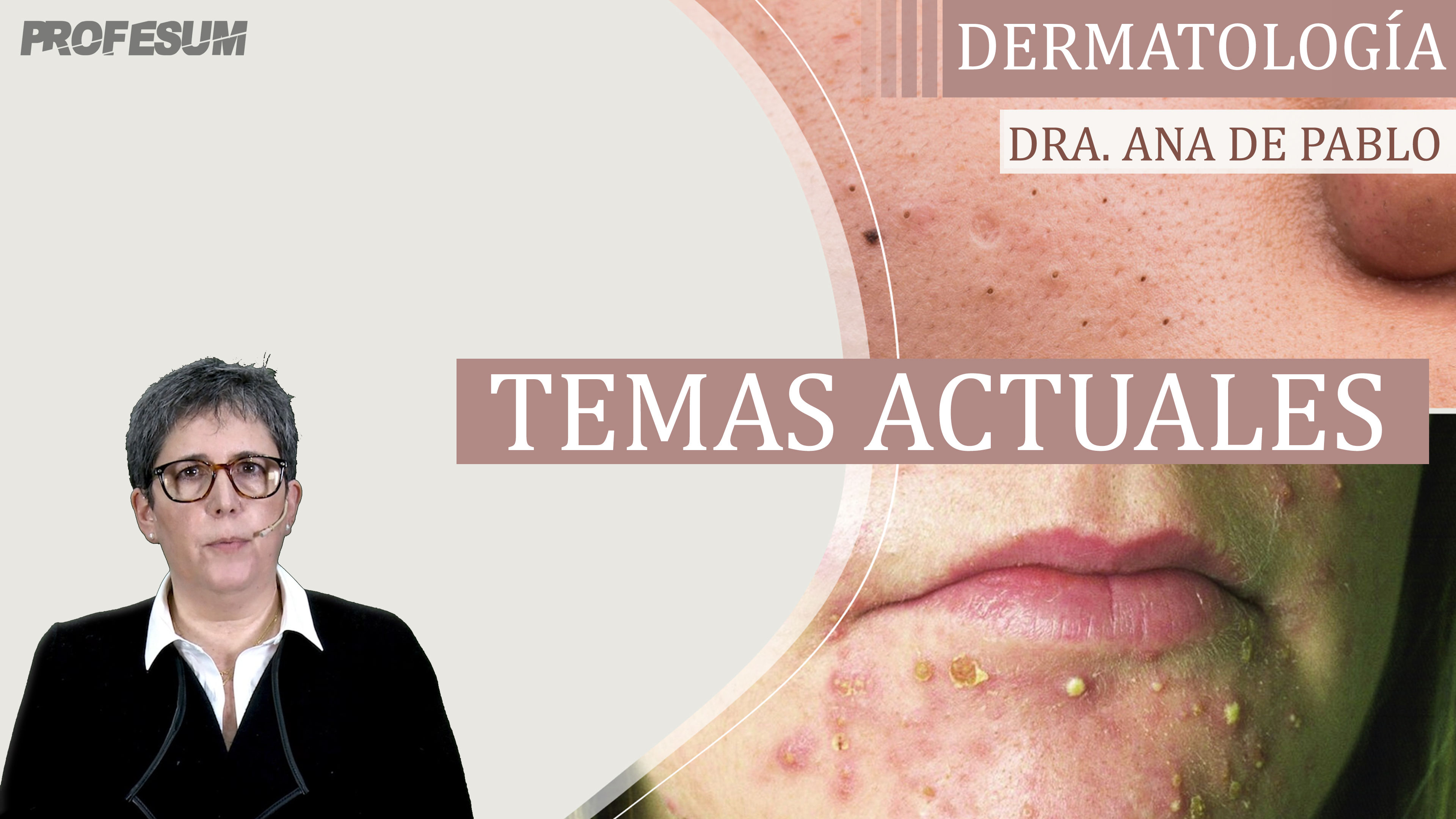 Temas Actuales - Dra. De Pablo