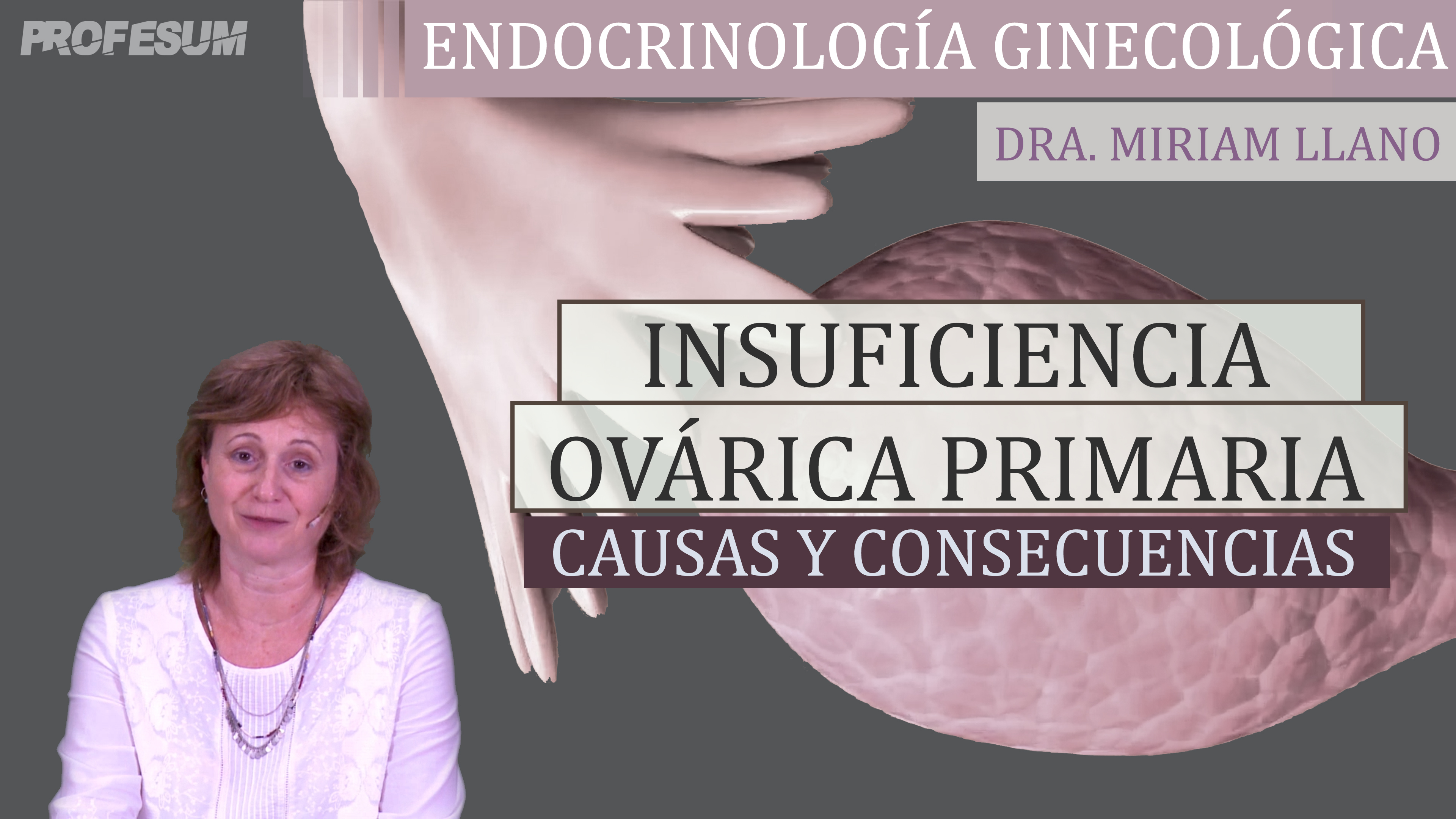 Insuficiencia Ovárica Primaria - Dra. Miriam Llano