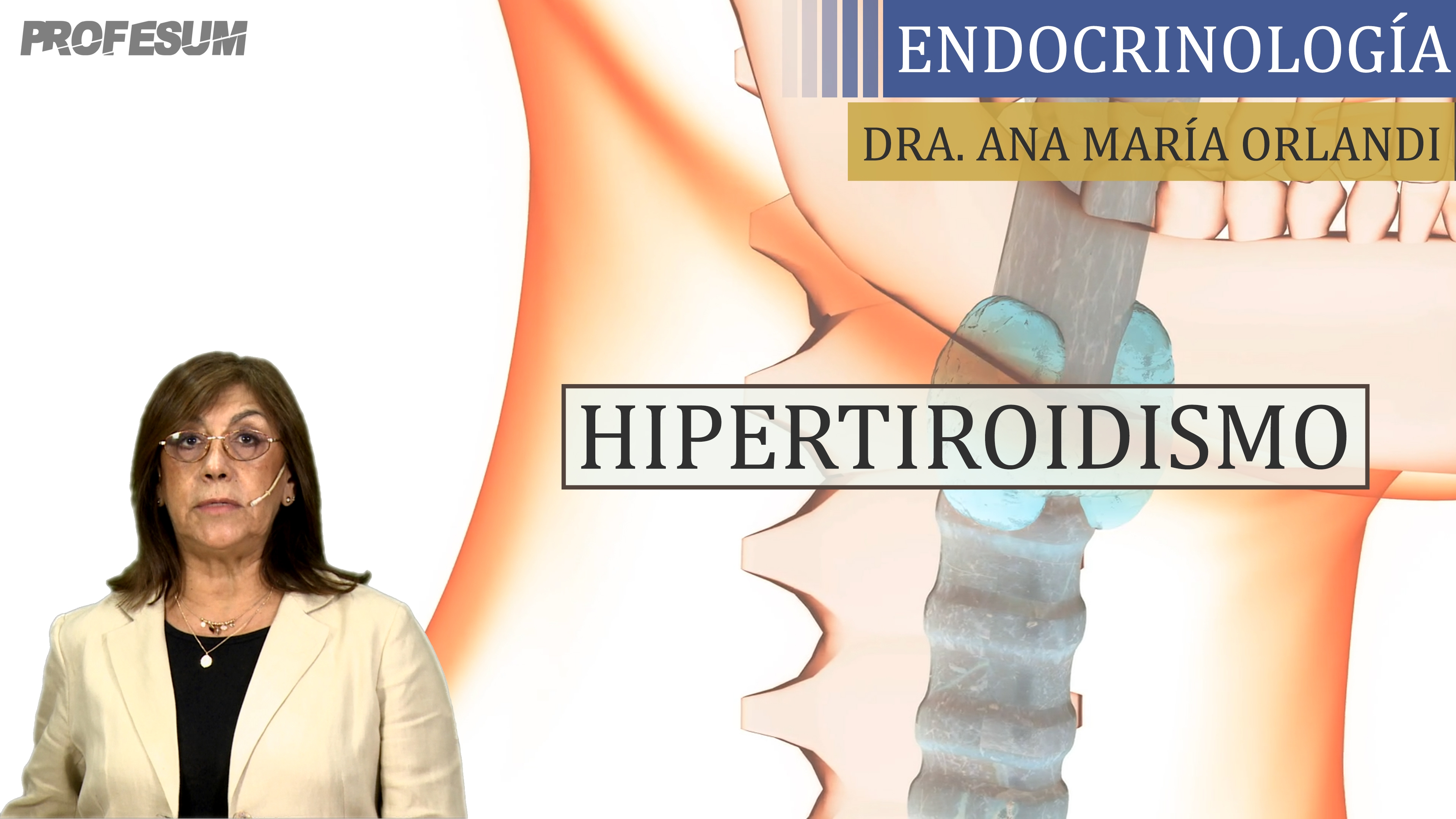 Hipertiroidismo - Dra. Ana María Orlandi