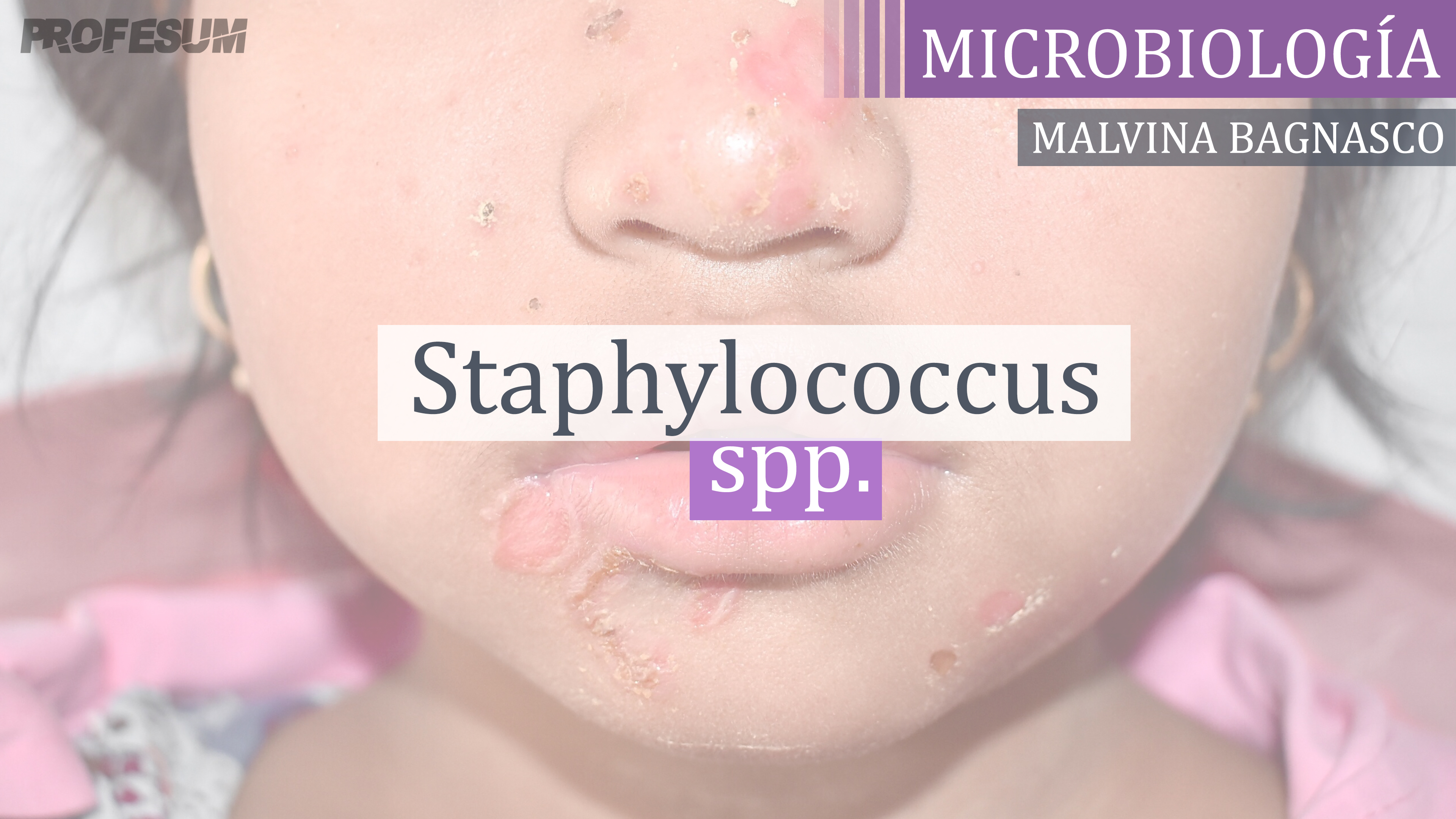 Staphylococcus spp. - Malvina Bagnasco