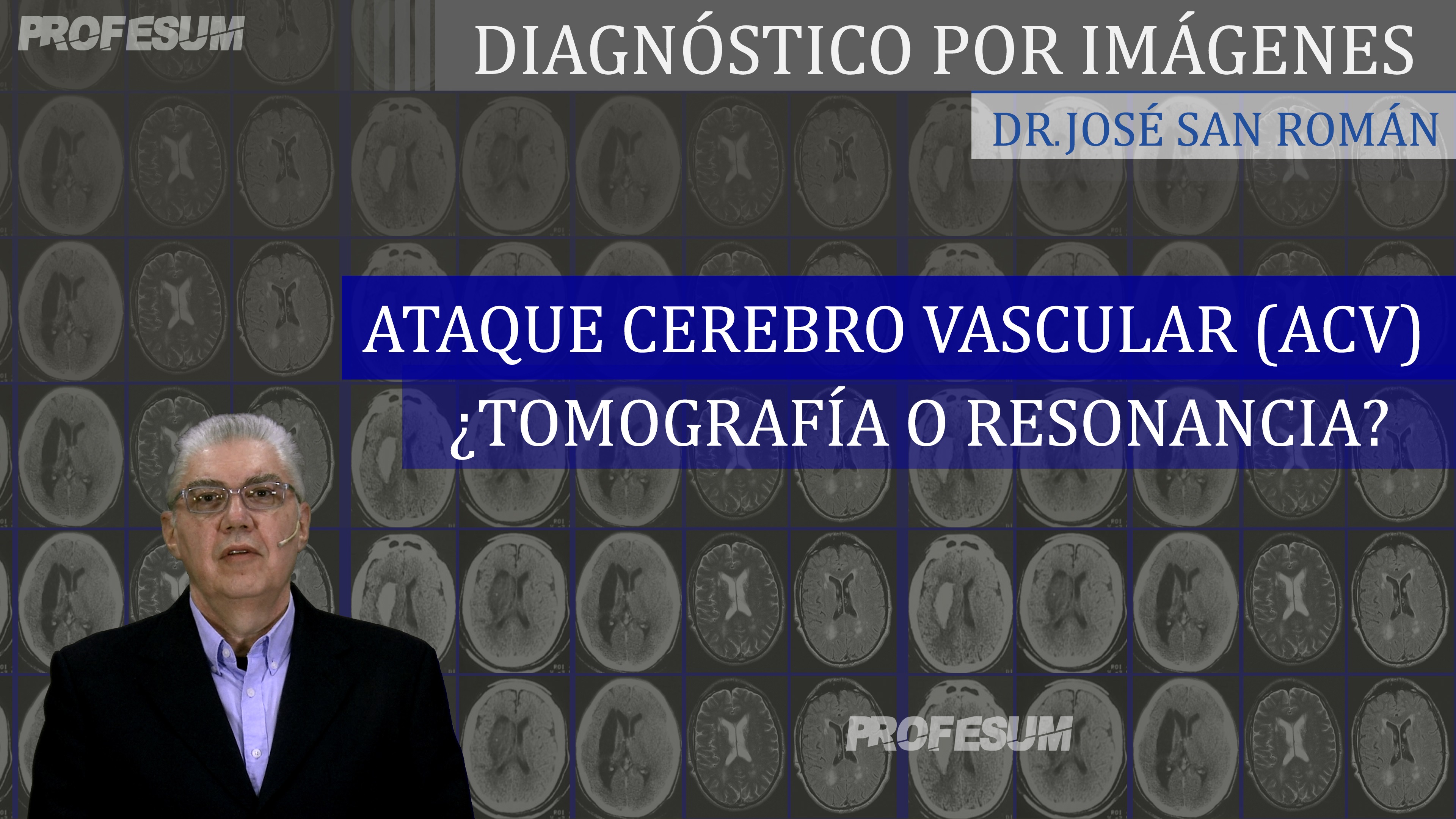 Ataque Cerebrovascular (ACV) ¿Tomografía o Resonancia? - Dr. José San Román