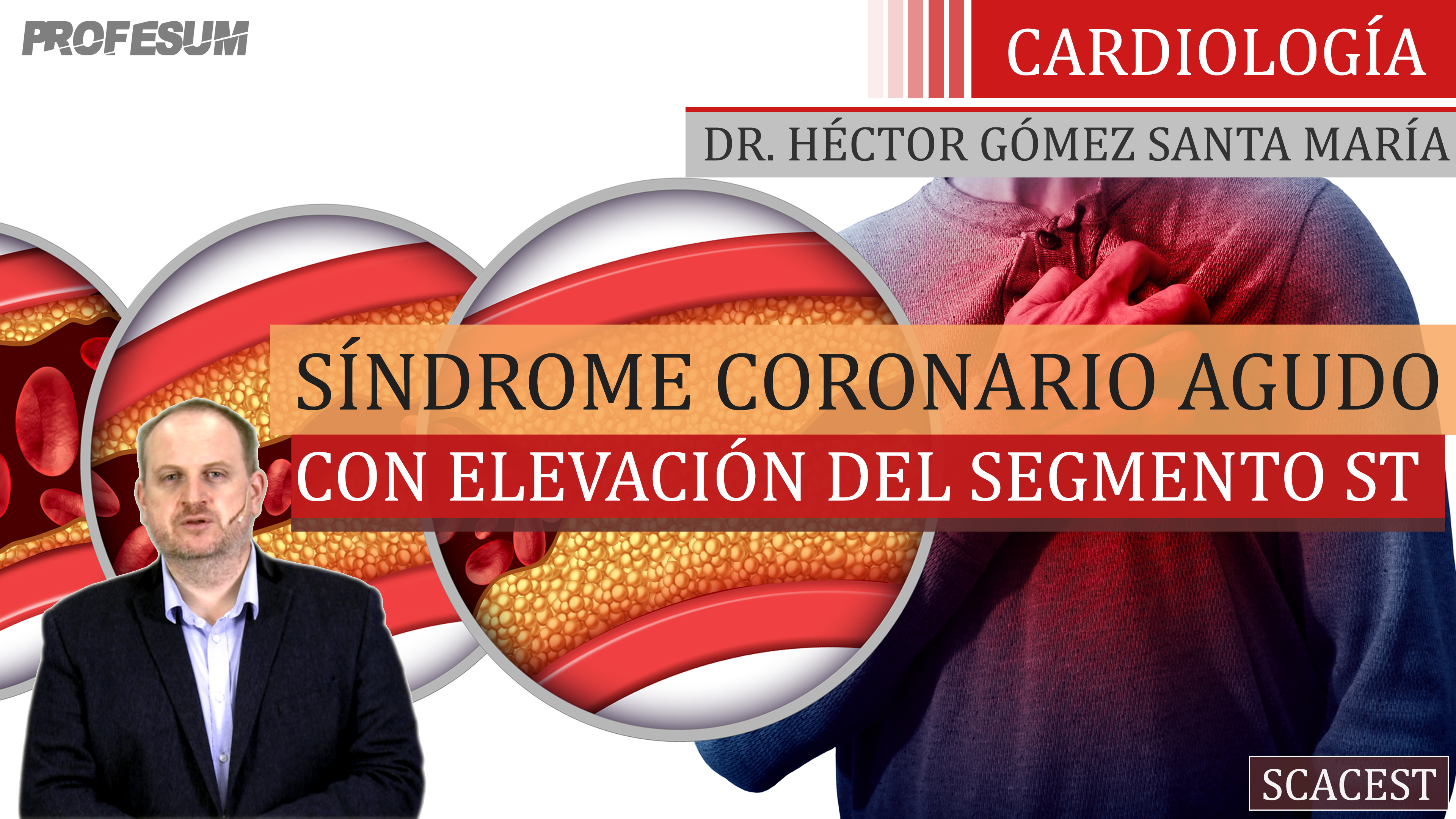 SCACEST - Dr. Héctor Gómez Santa María