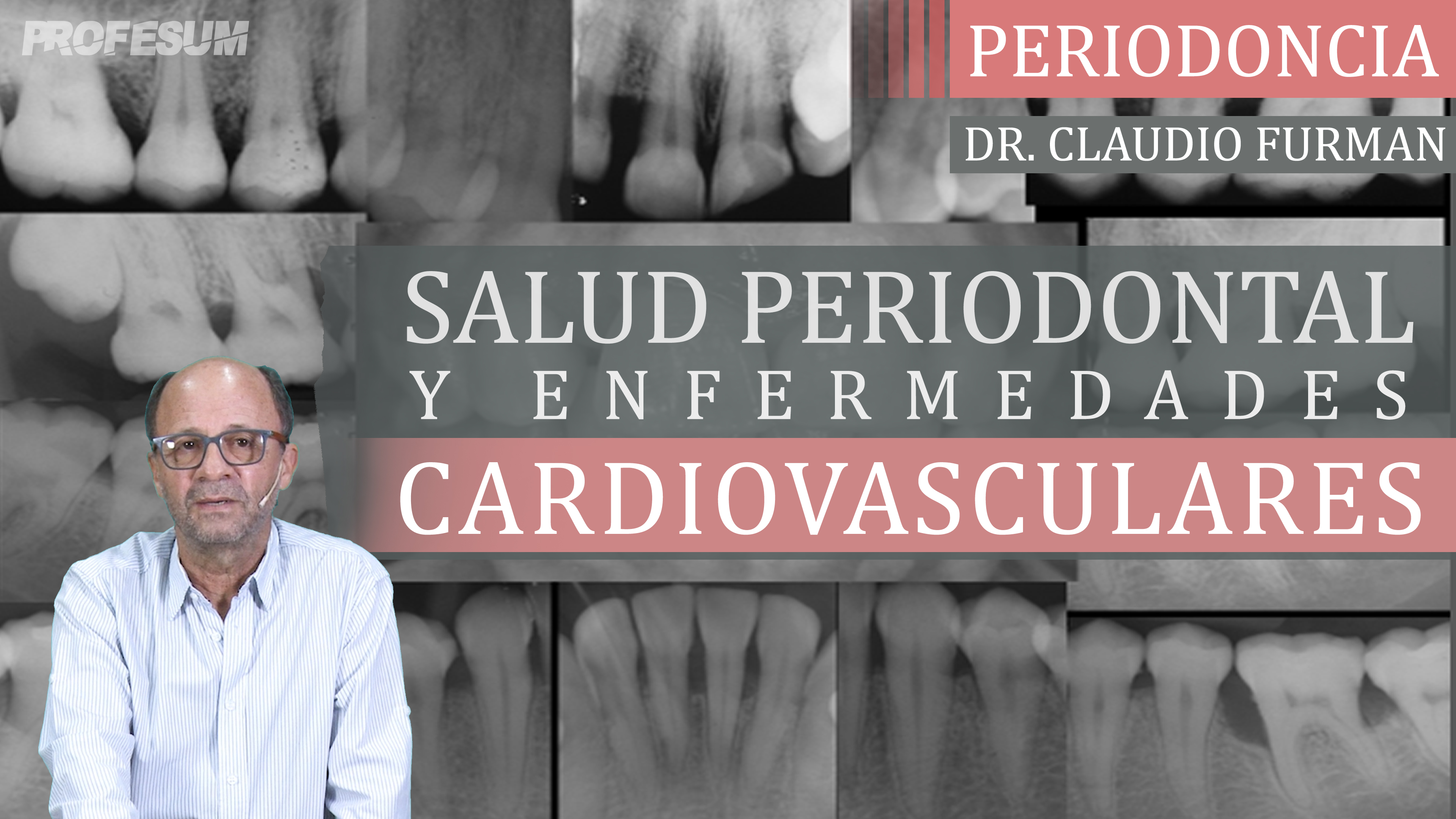 Salud Periodontal y Enfermedades Cardiovasculares - Dr. Claudio Furman