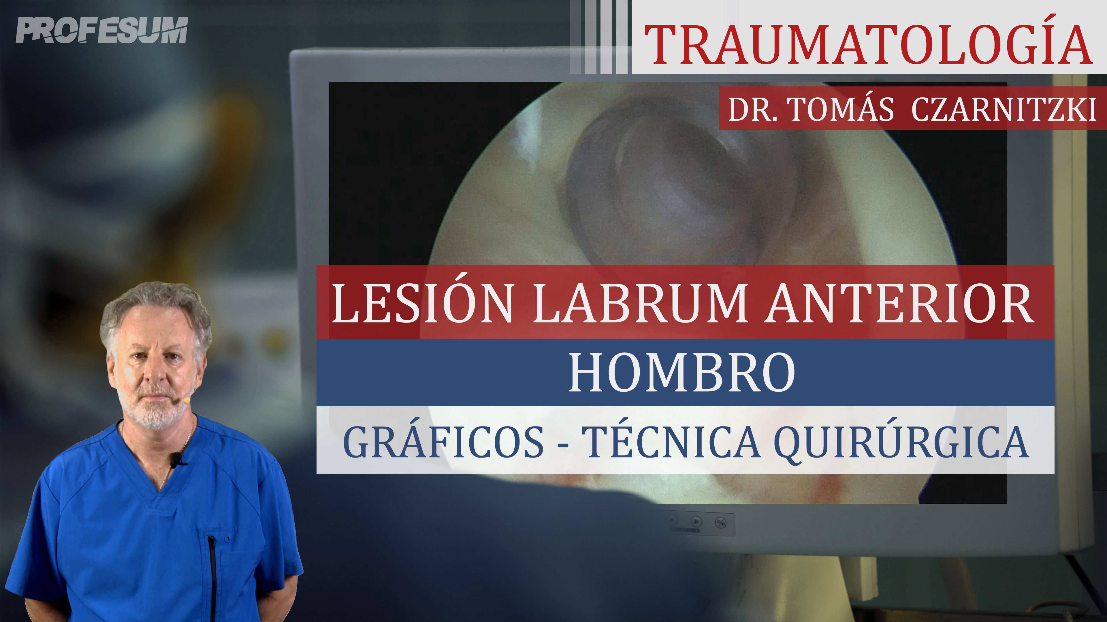 Lesión Labrum Anterior - Gráficos - Técnica Quirúrgica - Imágenes
