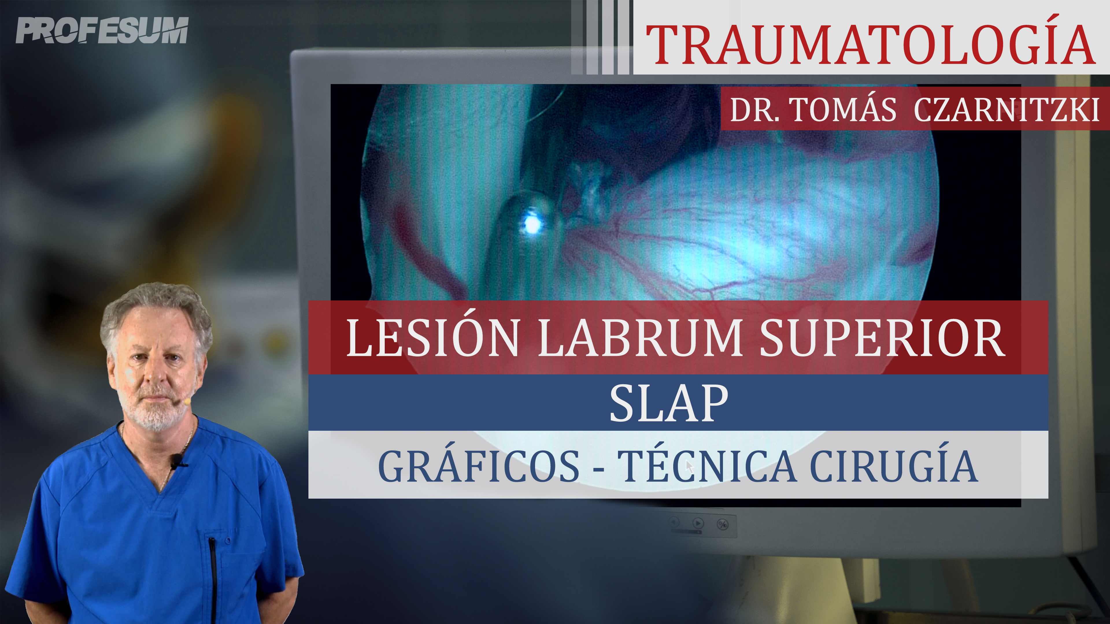 SLAP Lesión Labrum Superior - Dr. Tomas Czarnitzki