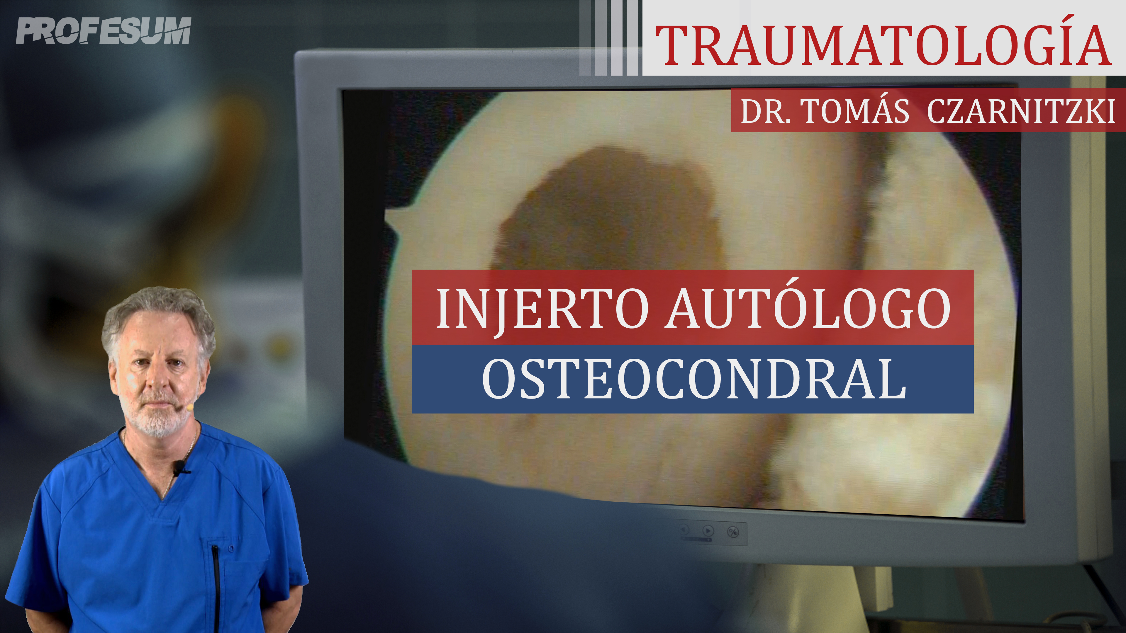 Injerto Autólogo Osteocondral - Osteocartilaginoso (Mosaicoplastía)