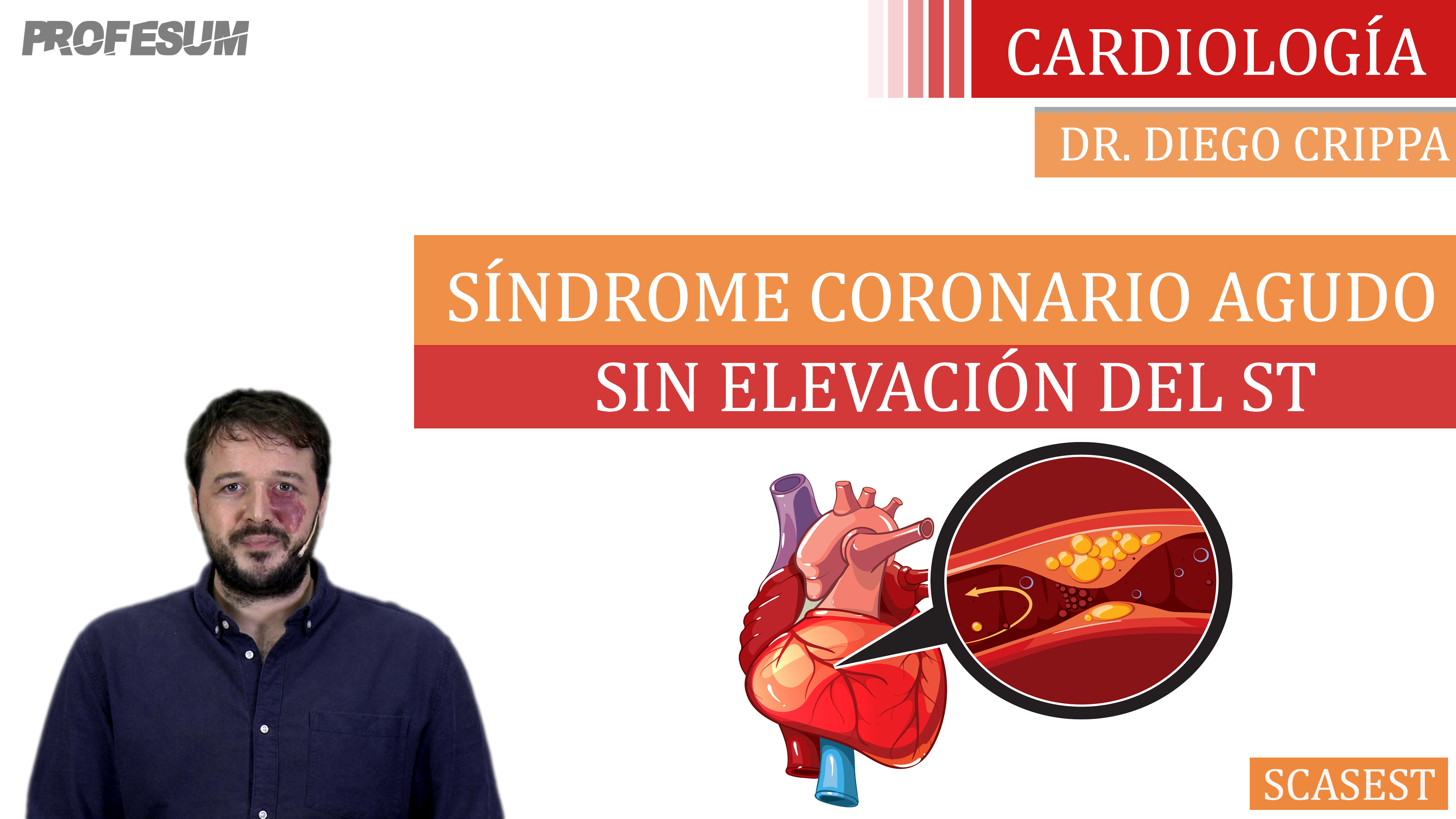 SCASEST Manejo Inicial - Dr. Diego Crippa