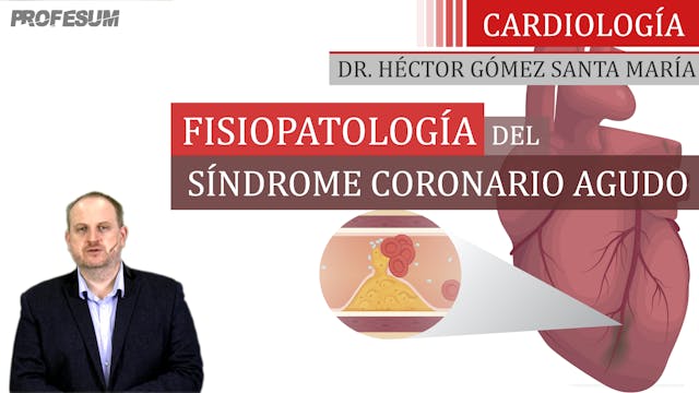 Fisiopatología del SCA - Dr. Héctor G...