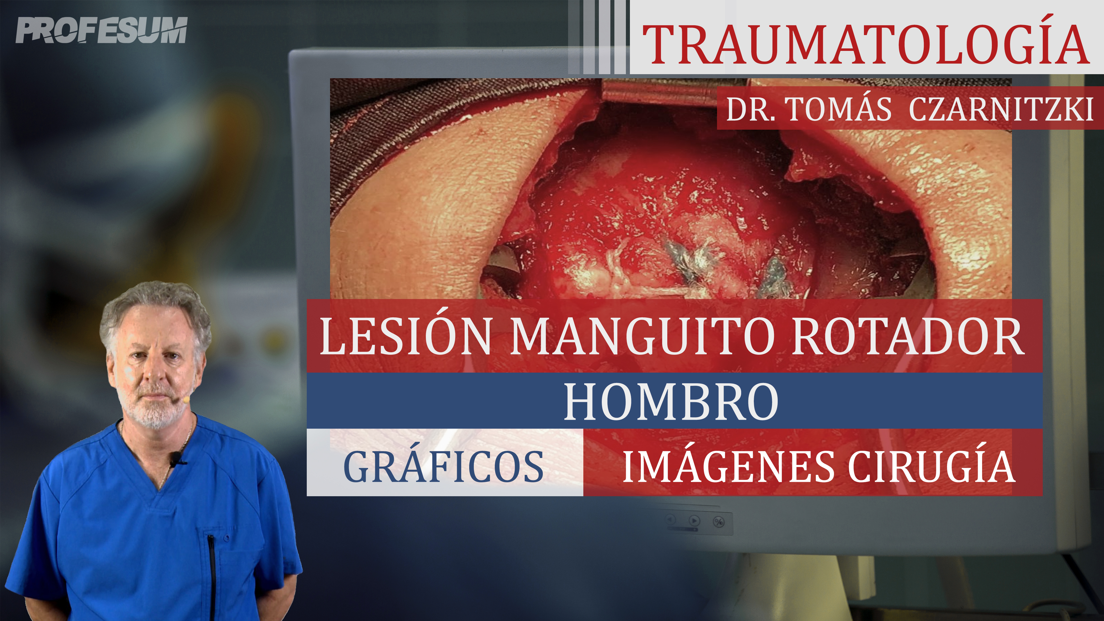Lesión Manguito Rotador - Hombro - Dr. Tomas Czarnitzki