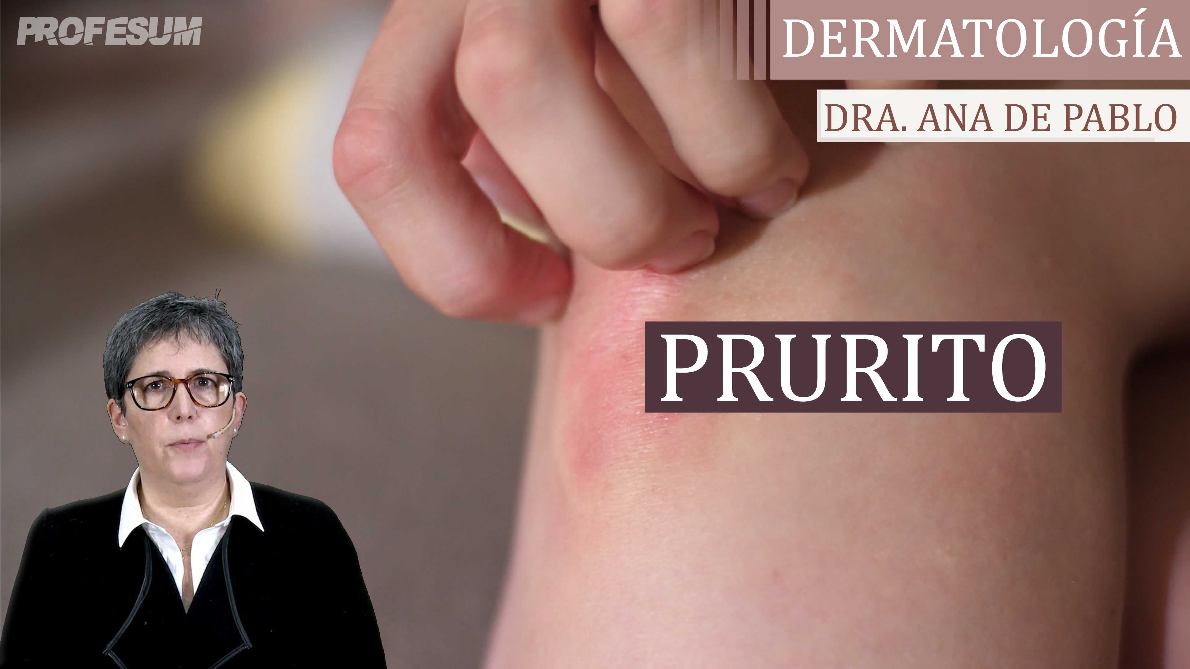 Prurito - Dra. Ana De Pablo
