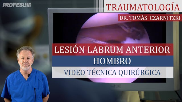 Lesión Labrum Anterior Hombro - Dr. T...