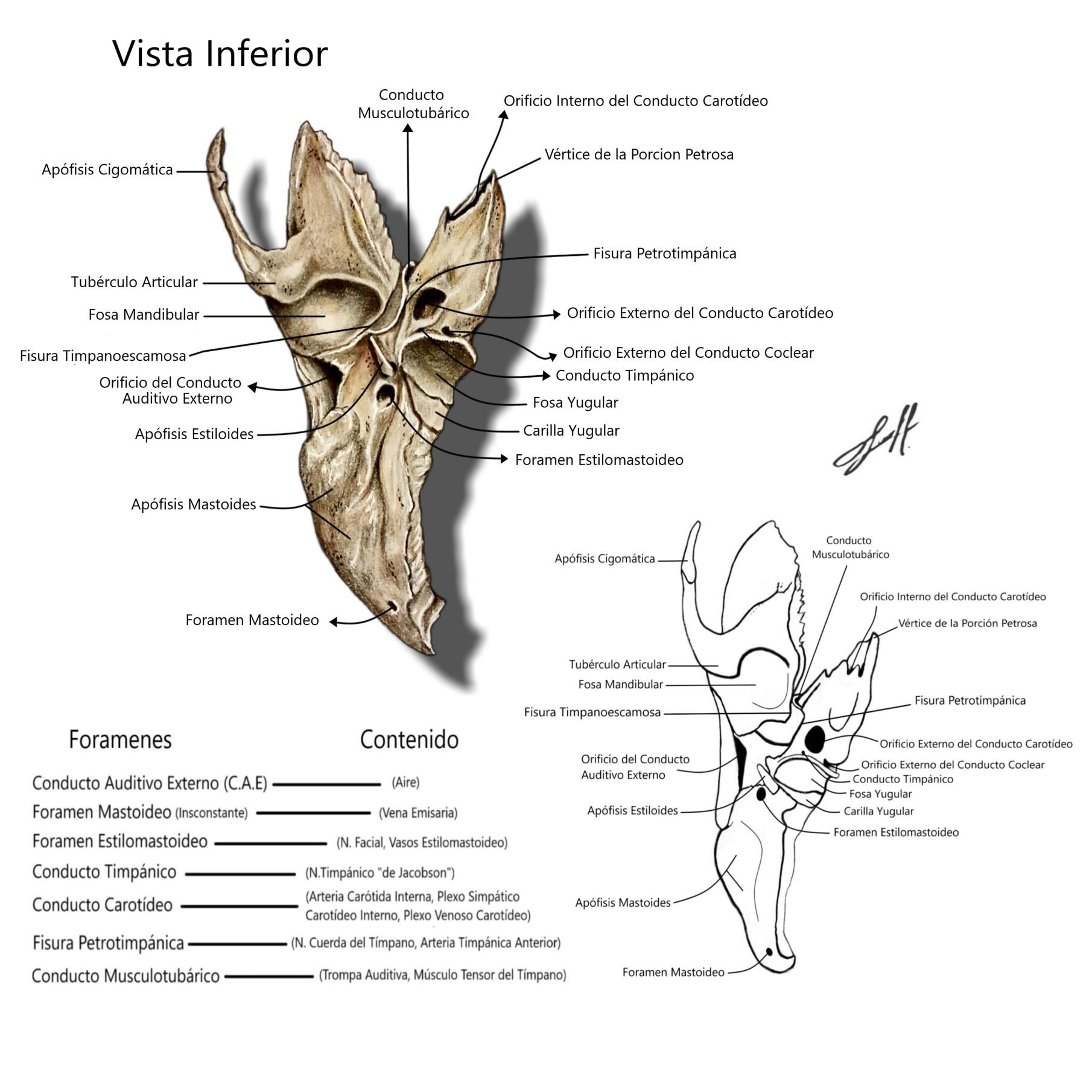 Hueso Temporal Vista Inferior
