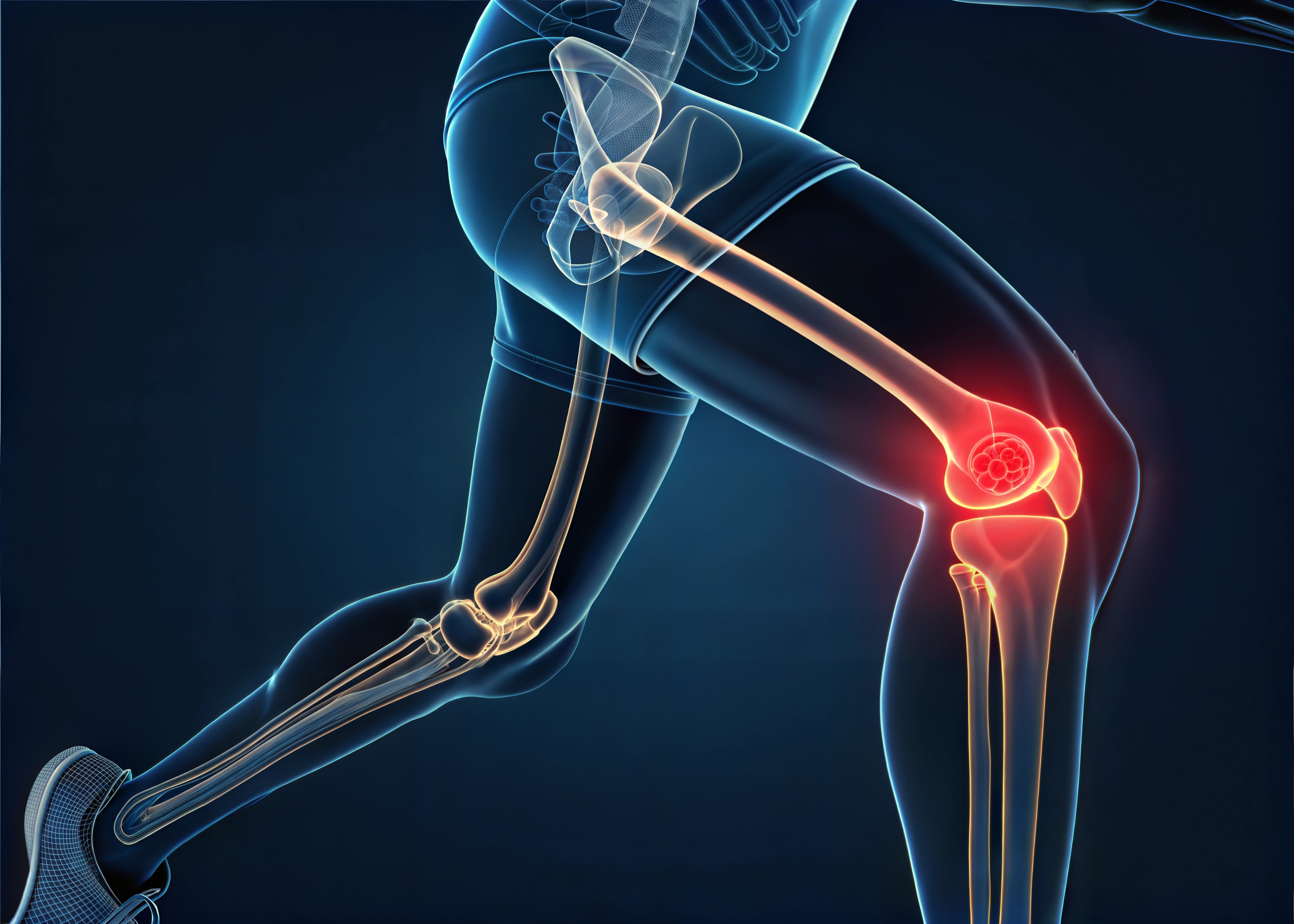 L4 - Knees