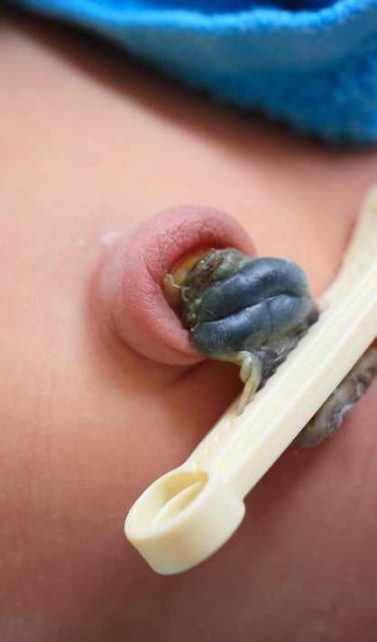 What does the belly button do?