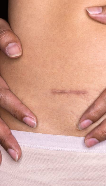 What function does the appendix serve?