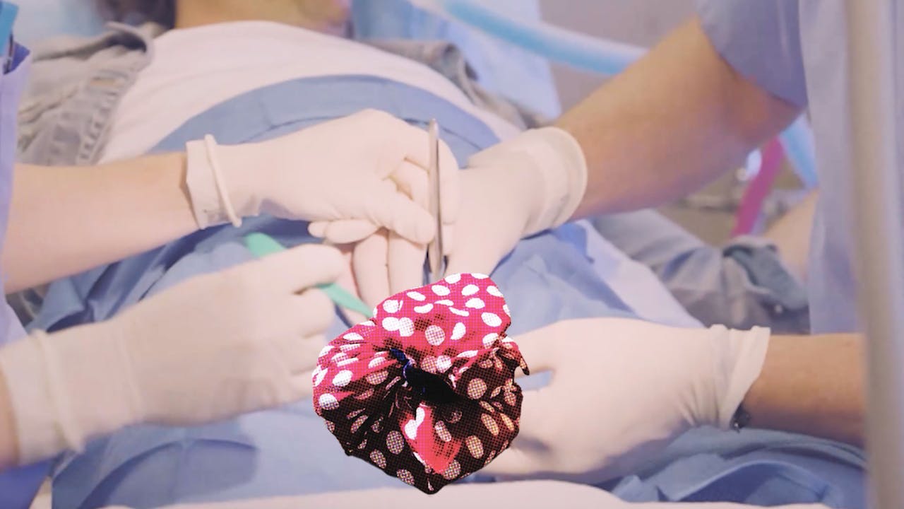 Vasectomy for Women's Rights - $333 Edition