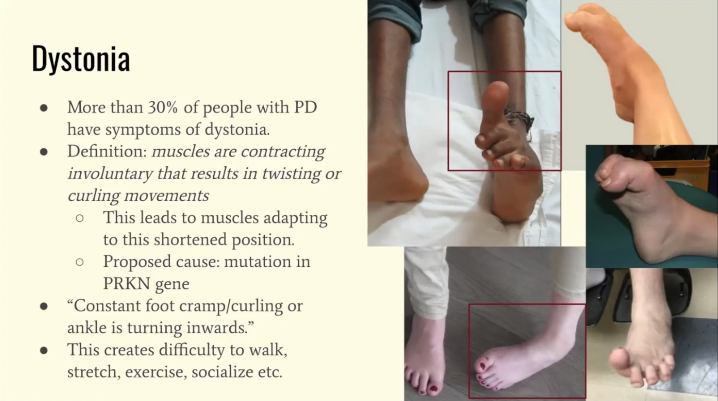 4-15-22 Foot Health Part 3