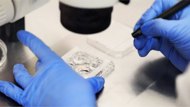 U.S. state rules frozen embryos are children