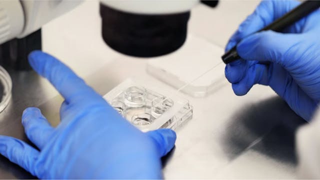 U.S. state rules frozen embryos are c...