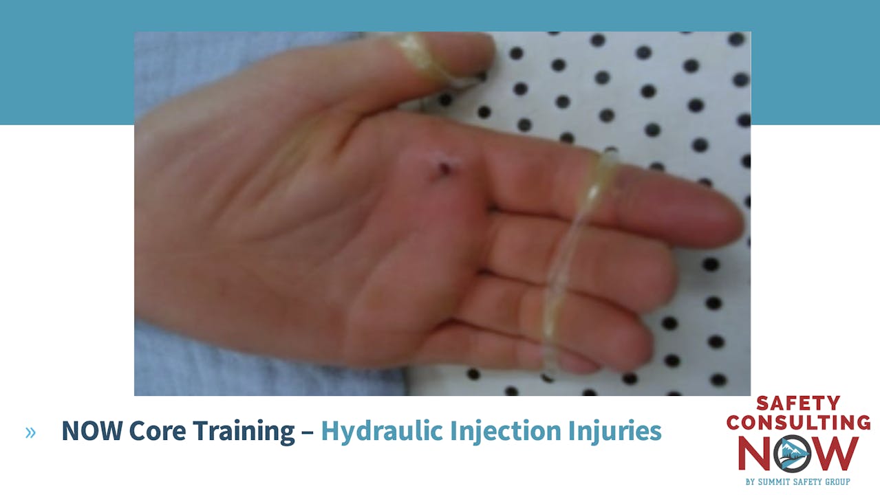 NOW Core Training Hydraulic Injection Injuries Safety Consulting NOW