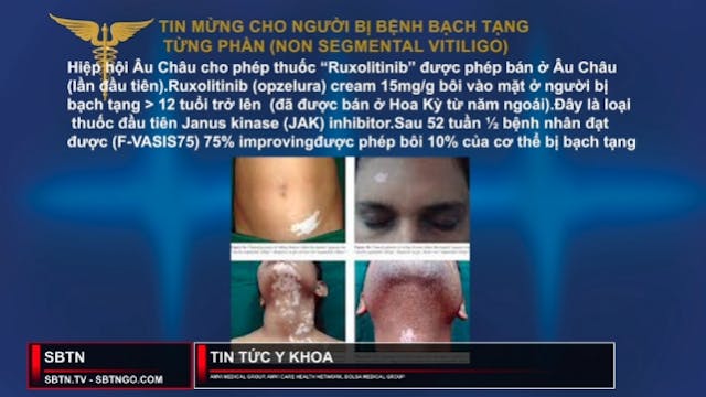 Tin Tức Y Khoa | 27/04/2023