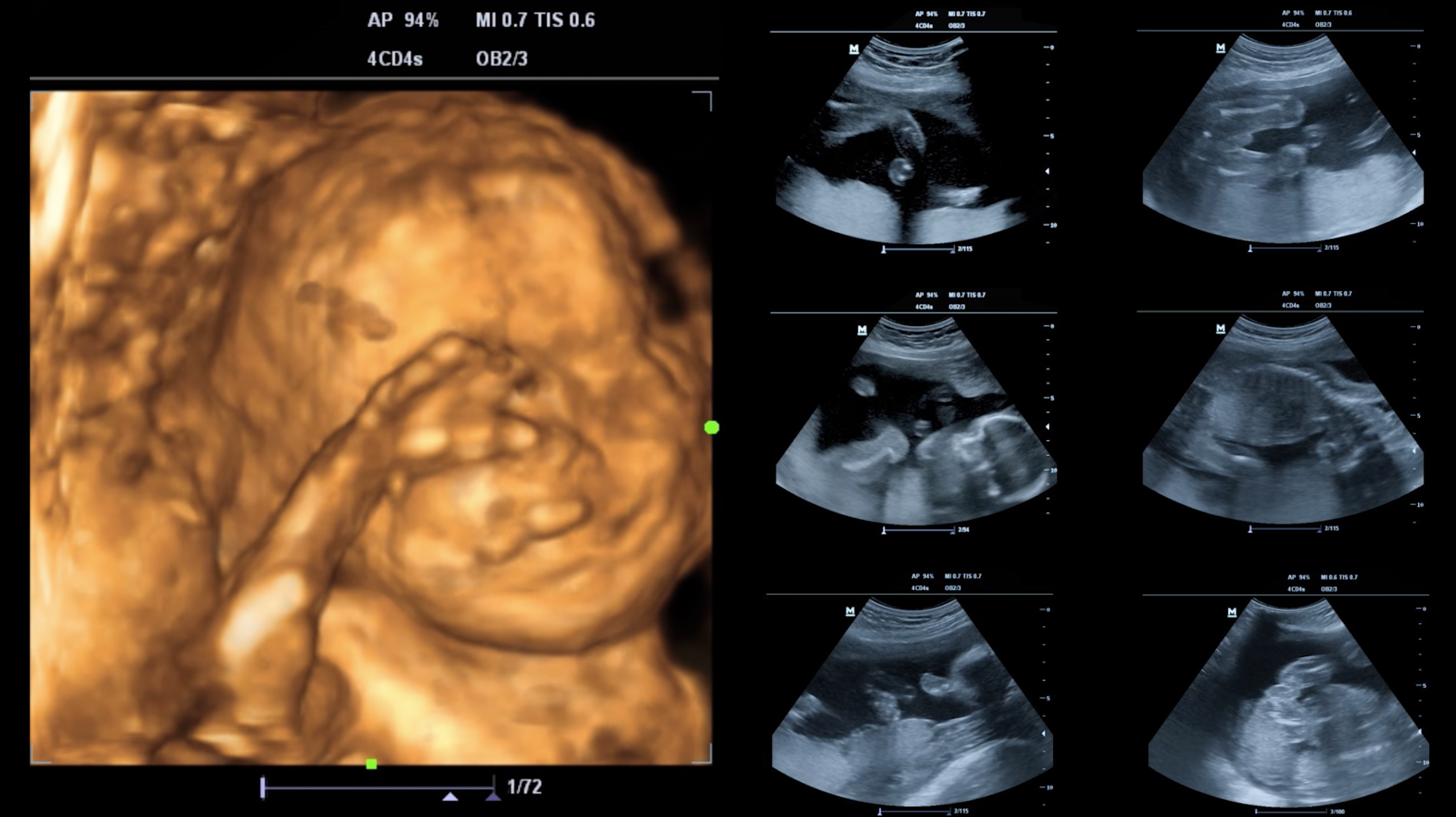 From the Womb the Birth of Trauma - Trailer