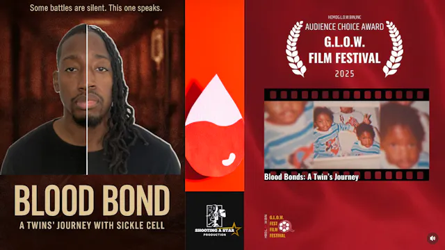 Blood Bond: A Twins' Journey with Sickle Cell