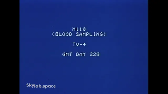 Movie_00_(DOY228 Blood Sampling)