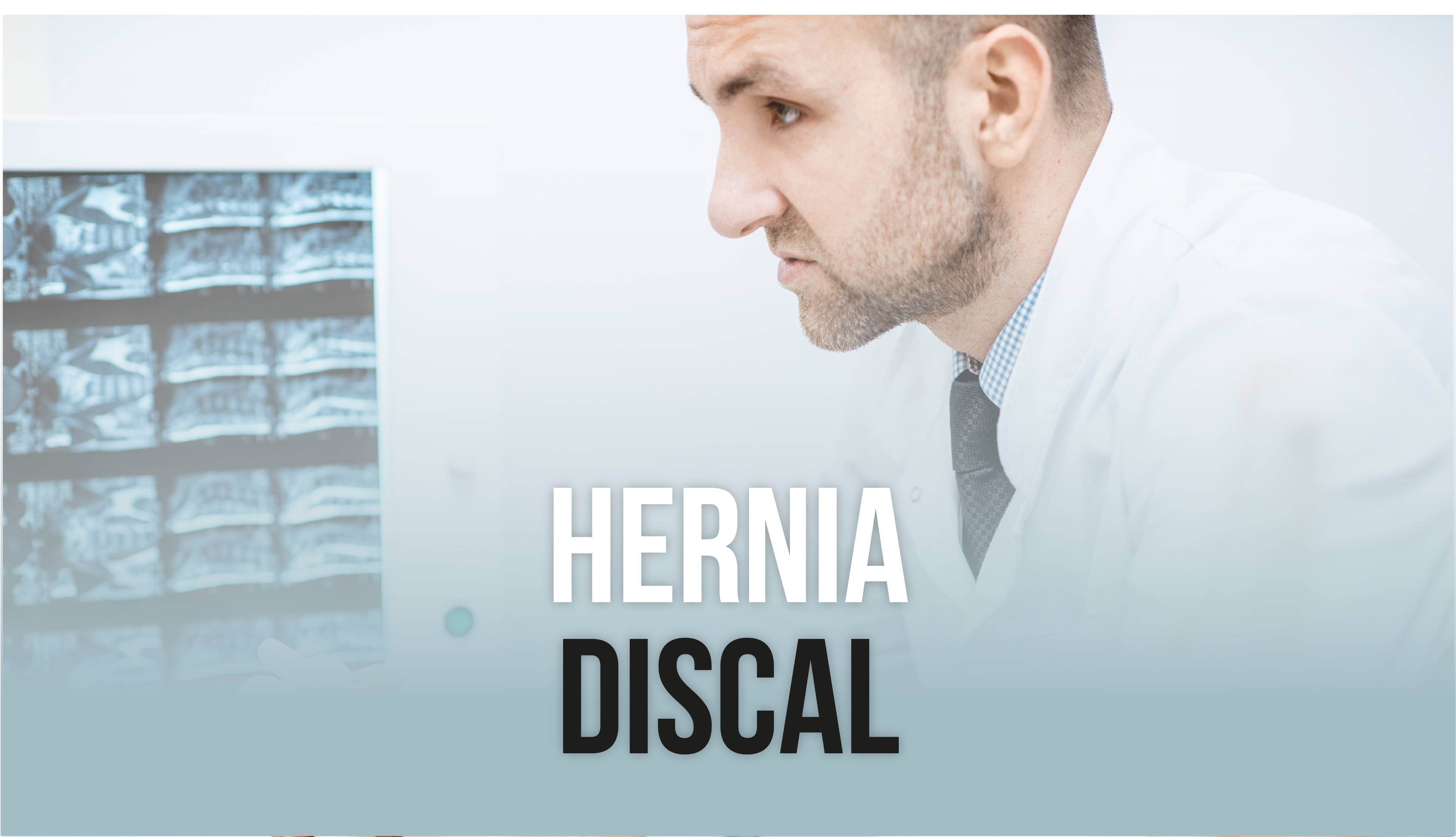 Hernia discal