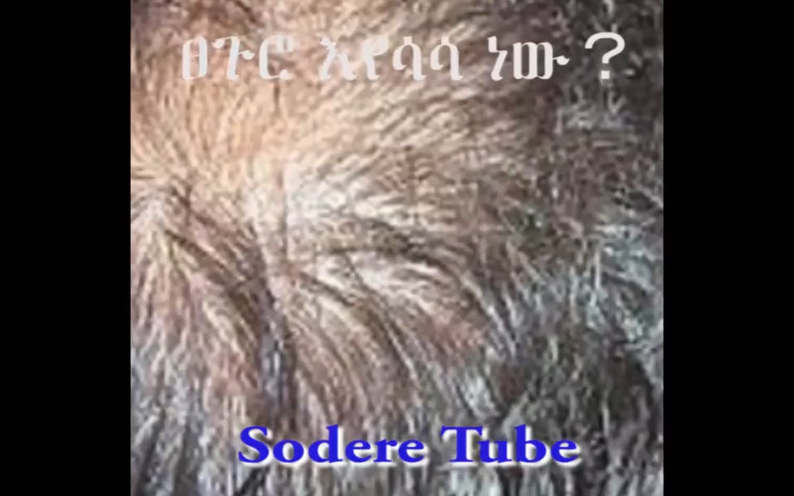 Ethiopia   … Is your hair thinning, hairline receding