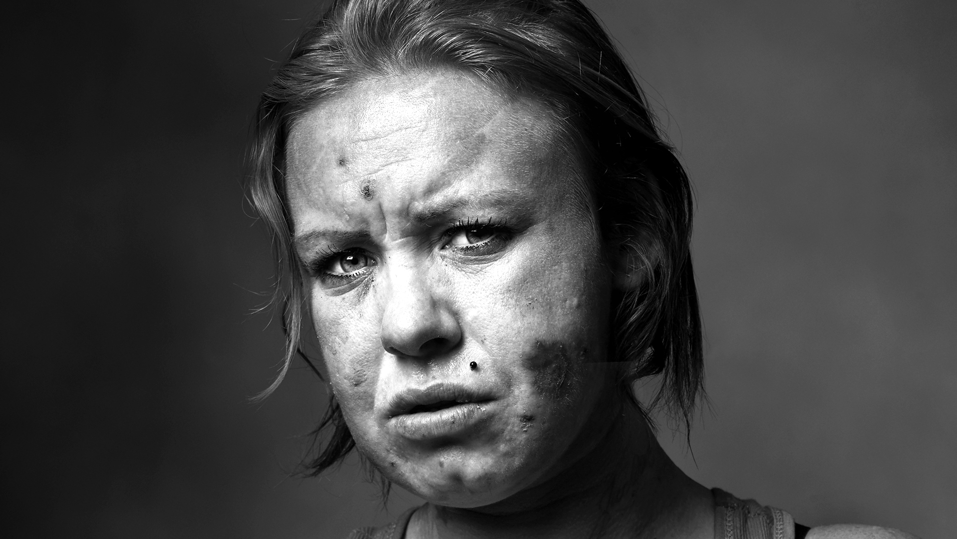 Addiction & Homelessness