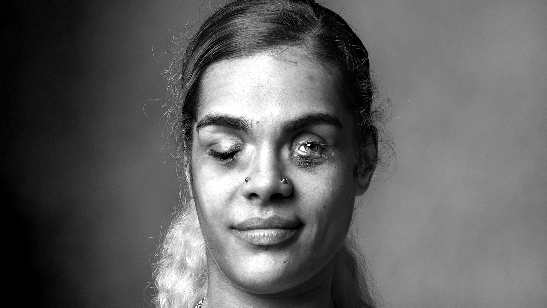 An Extreme Case of Domestic Violence-AK