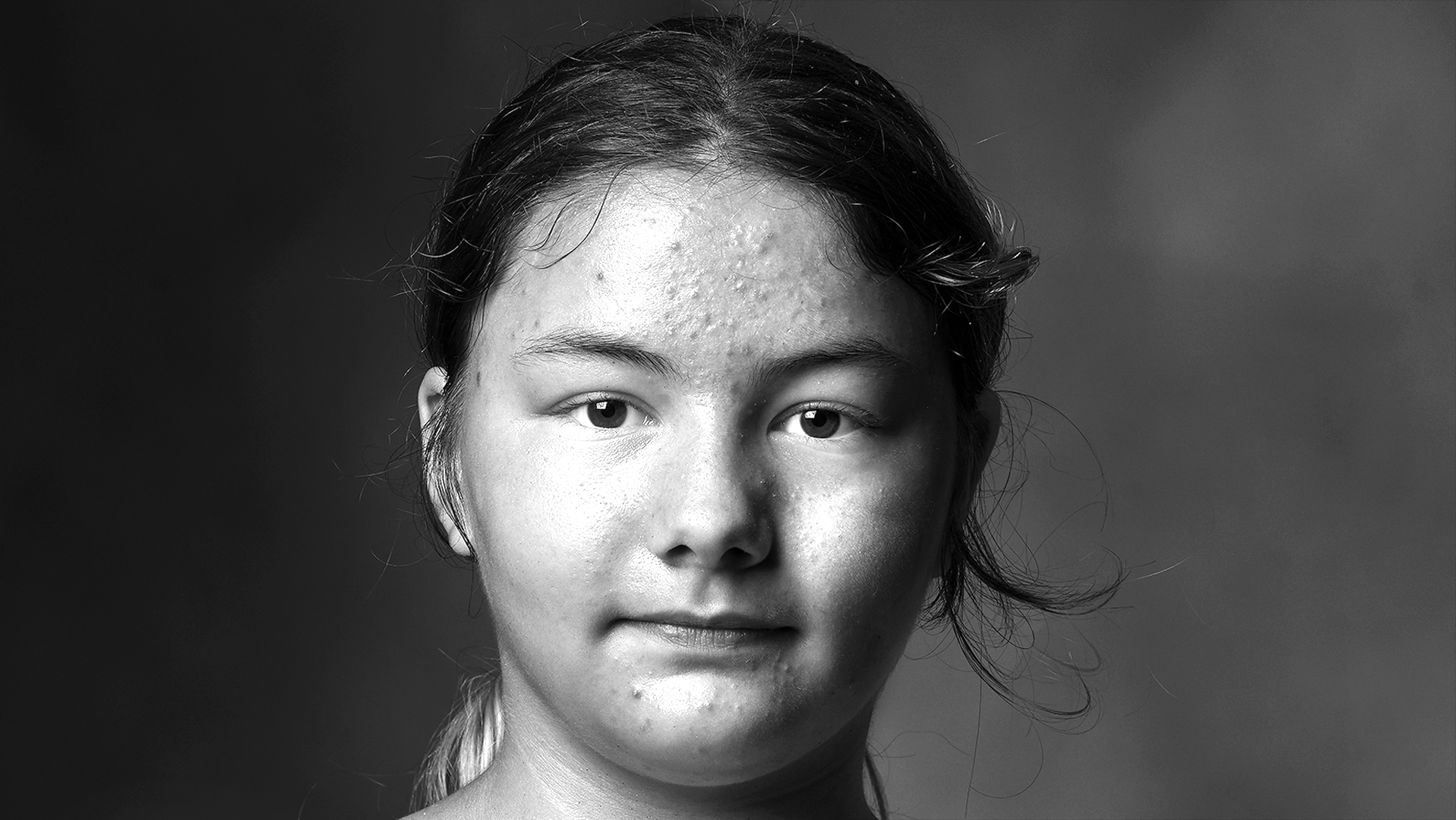 Eleven Year Old Skid Row Resident-Patience