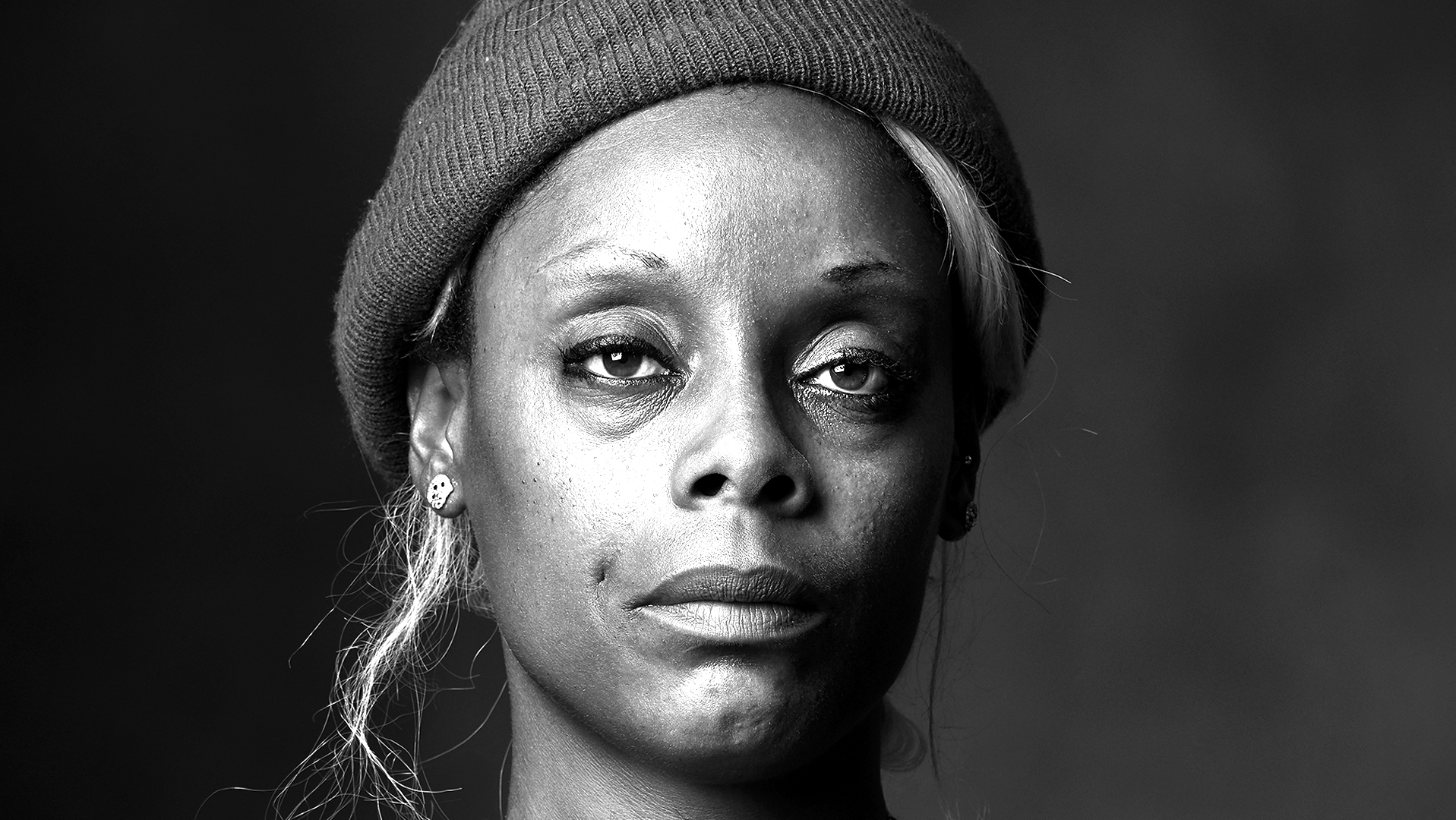 Crystal Meth Addict-Janet