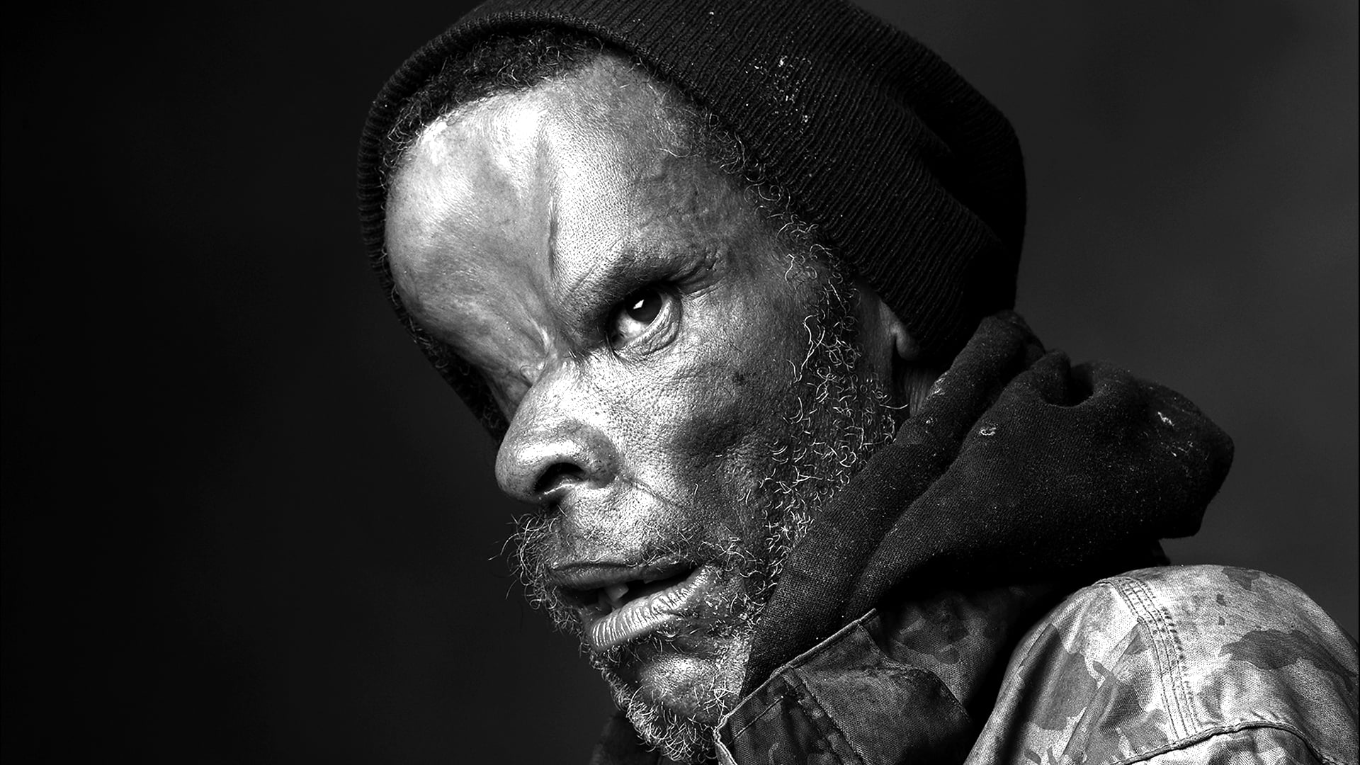 Shooting Victim-Jerry 2020 (part 2)