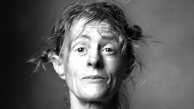 Untreated, Unhoused and Unwanted-Amber