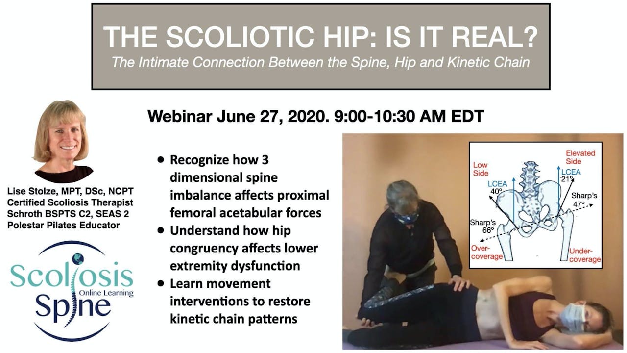 Scoliotic Hip: Is It Real? Spine,Hip,Kinetic Chain