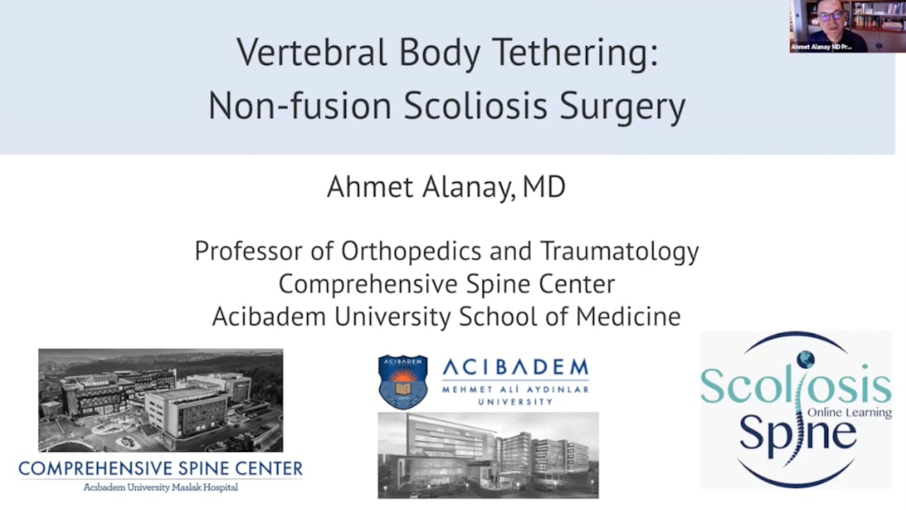 Vertebral Body Tethering (VBT) by Dr. Ahmet Alanay