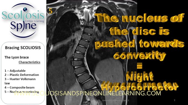 SSOL Bracing Webinar 2019