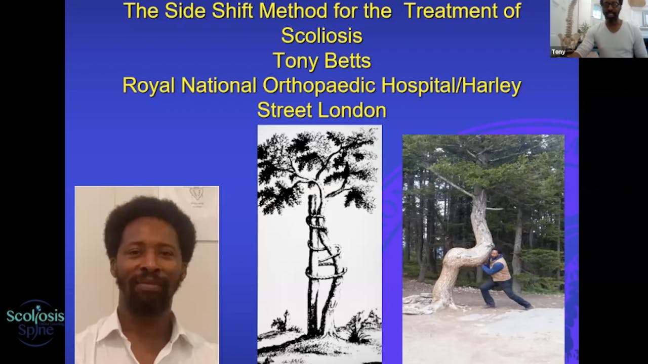 Side Shift Method for Scoliosis with Tony Betts