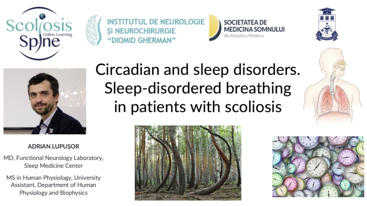 Sleep disordered breathing in Scoliosis patients