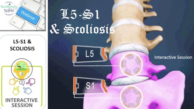 SSOL-Lyon Method Cert Tutorial 16: L5-S1&Scoliosis