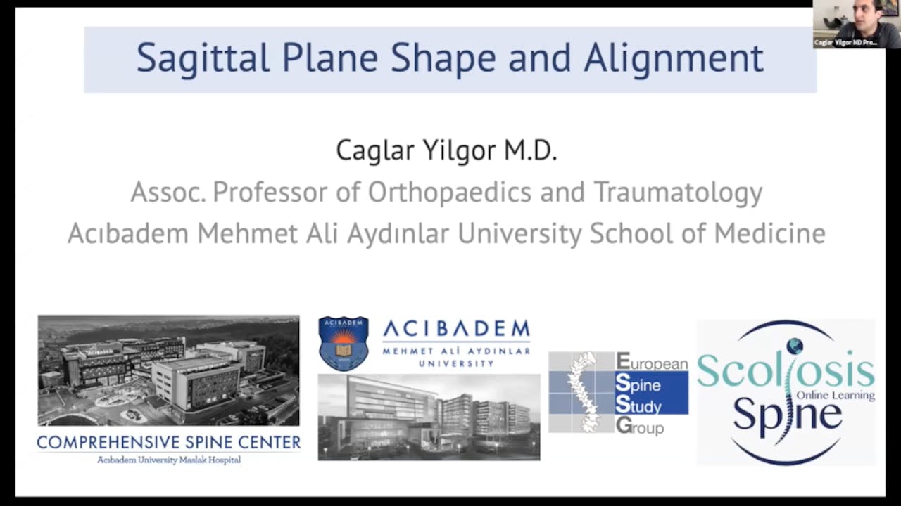 Global Balance-Sagittal Alignment Dr Caglar Yilgor
