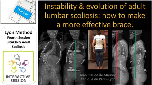 SSOL-LYON Method Certification Tutorial 4: Adult Scoliosis Bracing