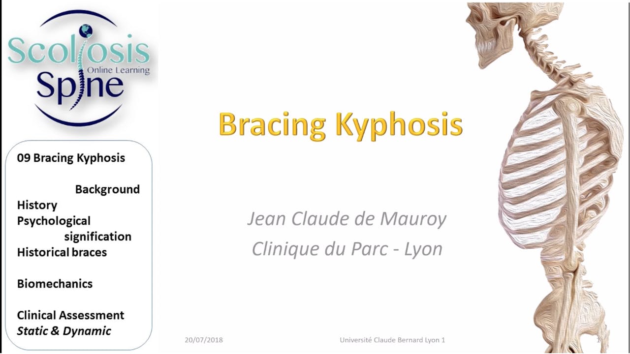 Bracing Kyphosis by Dr. Jean-Claude de Mauroy