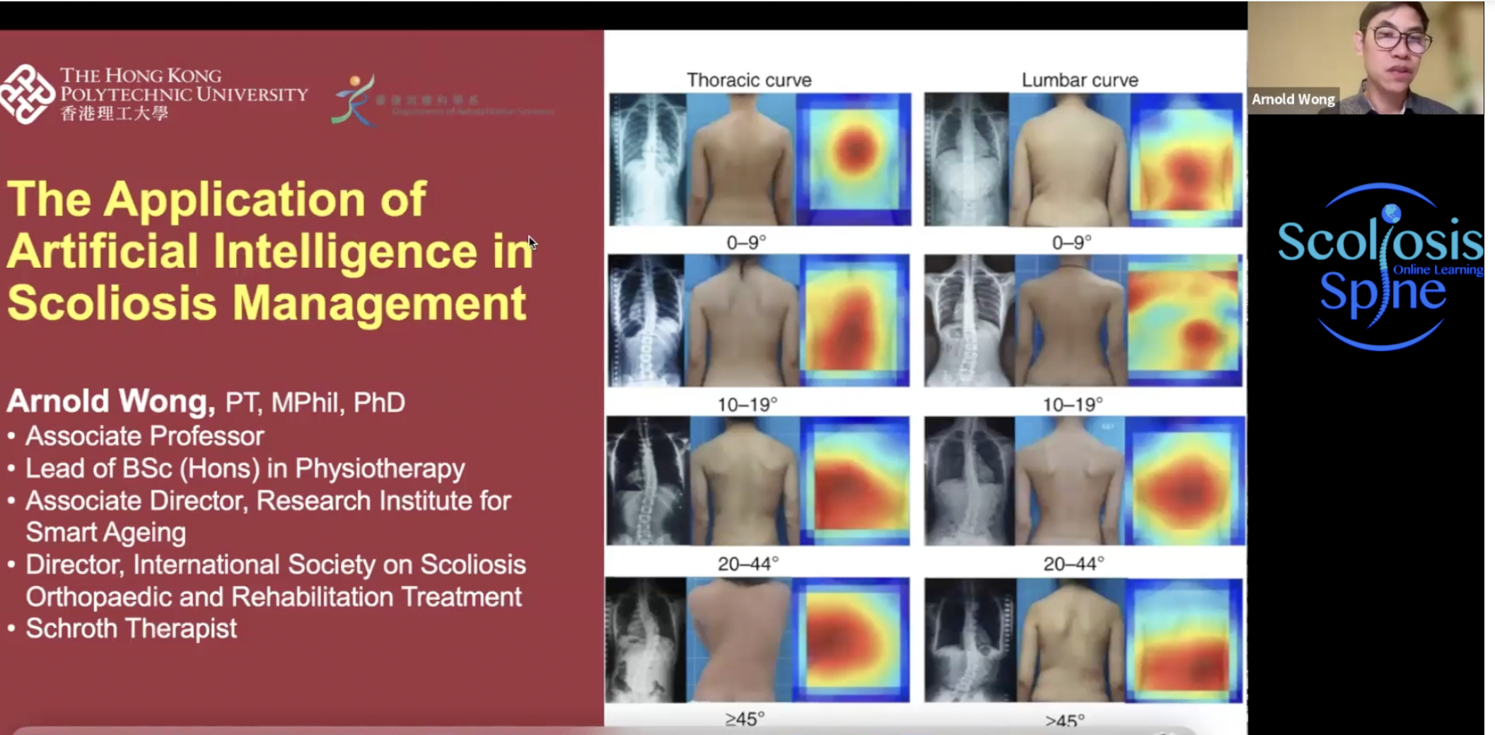 Application of Artificial Intelligence in Scoliosis Management by Dr.Arnold Wong
