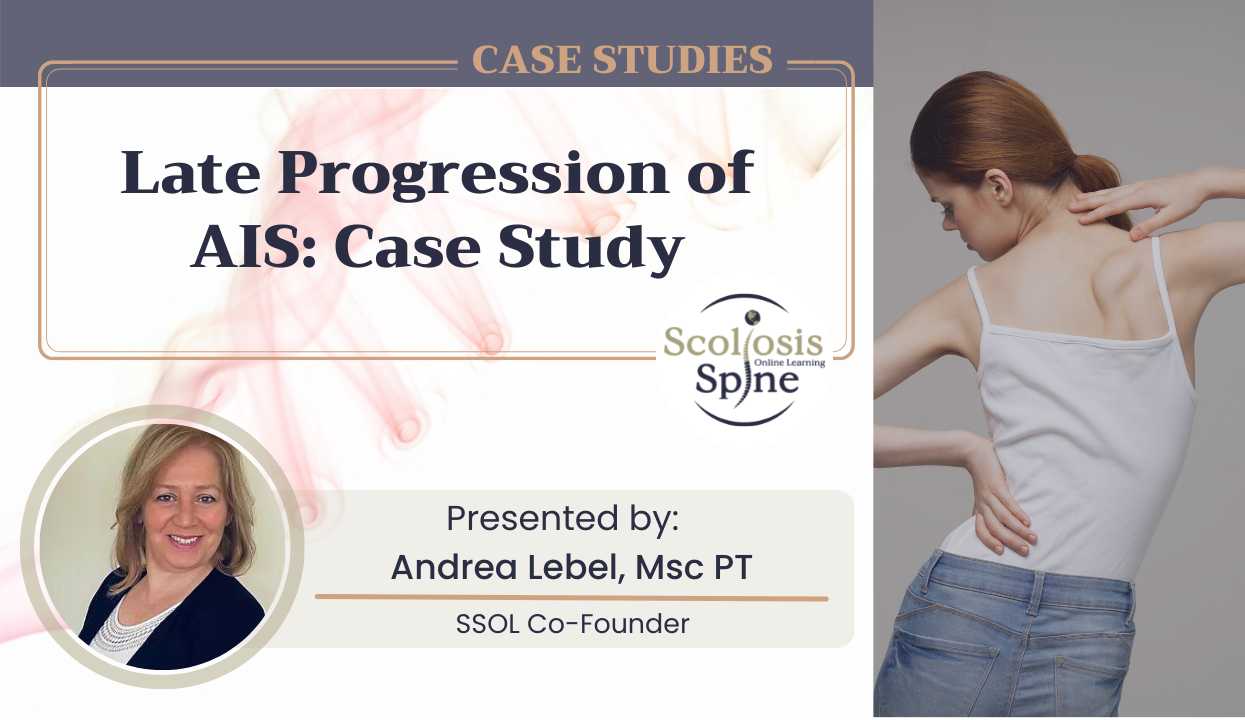 Late Progression of AIS: Case Study